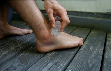 Cooling a hurt ankle (supination trauma with strained ligaments) with ice