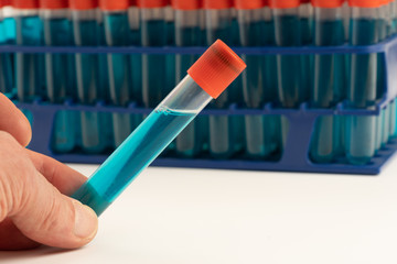 Test tubes with chemical samples