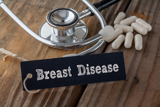Breast Disease written on label tag with pills and Stethoscope on wood background