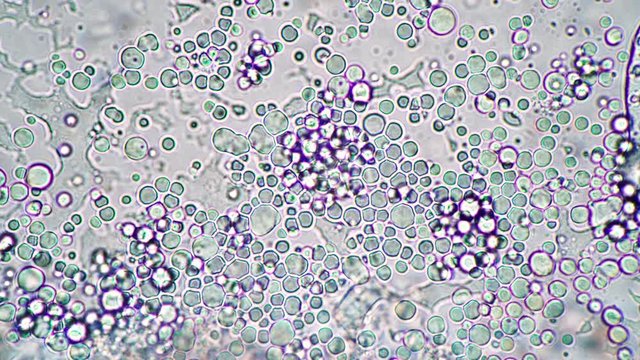 Bright microcosm of lactobacilli under the microscope. Microcosmic background. Theme of lactic acid foods is under 1000x magnification. Bacteria from an edible milk product such as kefir or yogurt.