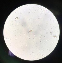 Egg parasite human in stool examination.