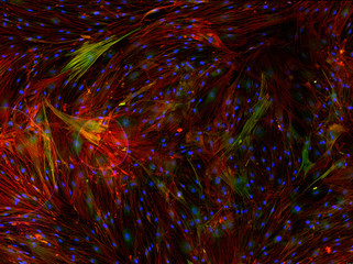 Real fluorescence microscopic view of human cells - human lung fibroblasts