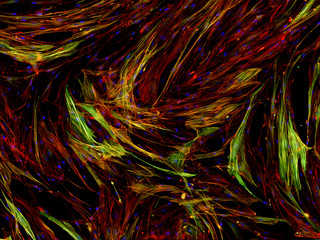 Real fluorescence microscopic view of human cells - human lung fibroblasts
