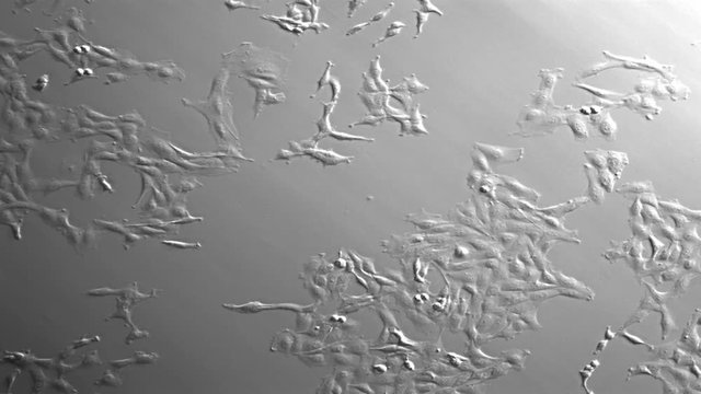 Movement, growth, and division of cancer cells in culture