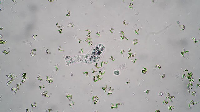 The microcosm of amoeba moves in water among algae close-up. Theme of laboratory biological research under microscope. Microscopic protozoa in a drop of water under magnification. Microcosm close-up.