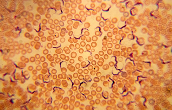 Trypanosoma vittatae Robertson, 1909 among red blood cells (turtle blood smear) - permanent microscope slide