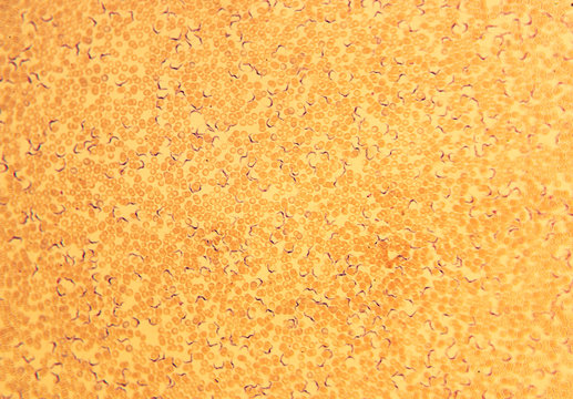 Trypanosoma vittatae Robertson, 1909 among red blood cells (turtle blood smear) - permanent microscope slide