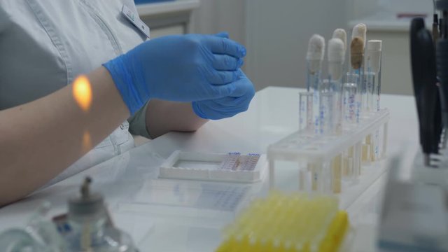 A woman in a medical laboratory checks the reaction of staph bacteria on different substances and antibiotics.