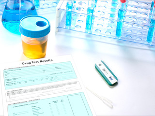 The detection of drugs in urine