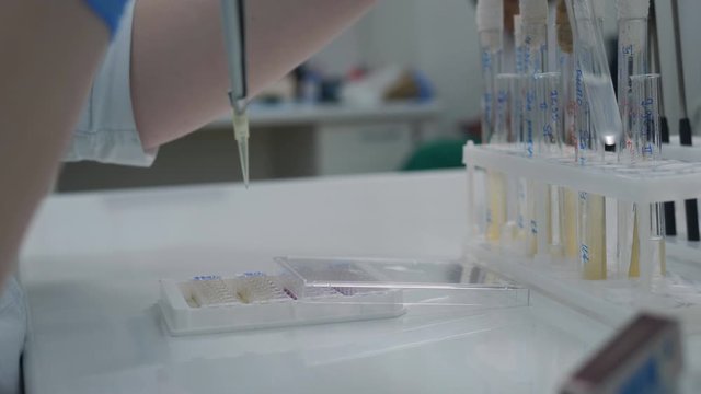 A woman in a medical laboratory checks the reaction of staph bacteria on different substances and antibiotics.