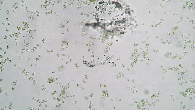 The amoeba moves slowly in a drop of water. Theme of laboratory biological research under microscope. Microscopic protozoa in a drop of water under magnification. Microcosm close-up.