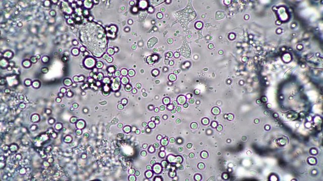 A large cluster of round lactobacilli in the milk leaven in a microscope. Microcosmic background. Theme of lactic acid foods is under 1000x magnification. Bacteria useful for human body from yogurt.