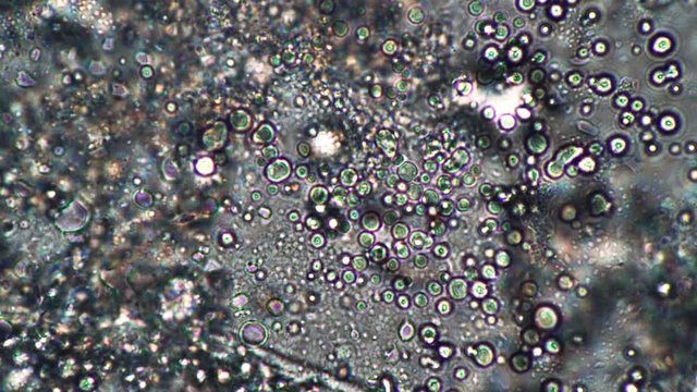 Microcosmic background Brownian motion of fat cells in dairy product. The theme of lactic acid foods is under 1000x magnification. Bacteria useful for the human body from yogurt.