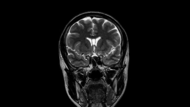 Brain MRI, head scans and tumor detection. Diagnostic medical tool