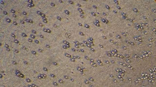 Microscopy of yeast cells (Saccharomyces cerevisiae). Magnification 300x with visible cells of granule shape.