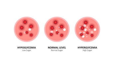 Glucose blood level sugar test. vector illustration