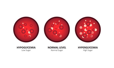 Glucose blood level sugar test. vector illustration