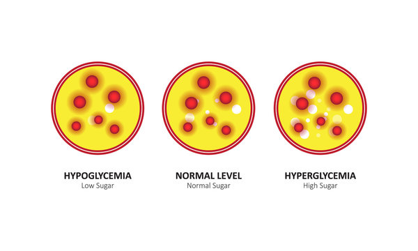 Glucose Blood Level Sugar Test. Vector Illustration