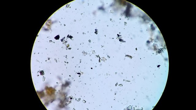 Fast moving protozoans swimming through pond water sample