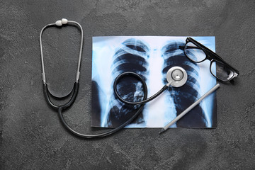 Stethoscope and X-ray image on grey background