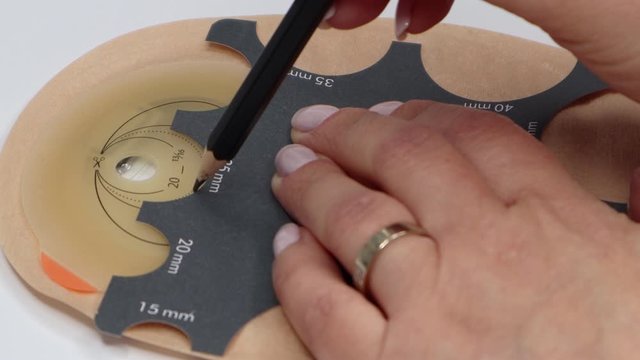 Colostomy bag, supply needed after colostomy surgery - colon cancer treatment. Ostomy bag in skin color. Medical theme. Stoma bag ready to use. Drawing hole for cutting opening with stoma guide.