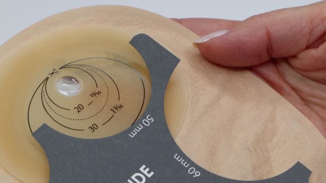 Colostomy bag, supply needed after colostomy surgery - colon cancer treatment. Ostomy bag in skin color. Medical theme. Choosing the correct size for opening with stoma guide.