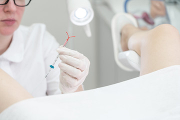 Gynecologist holding an IUD birth control device before using it for patient