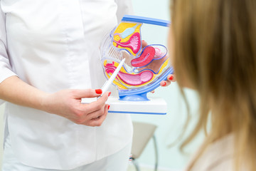 Gynecologist consulting patient using uterus anatomy model