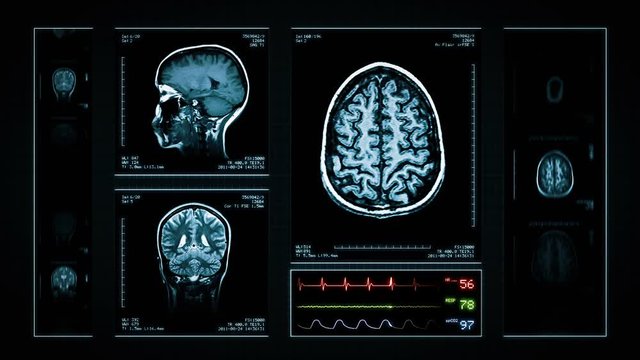 Brain MRI Scan. Blue. 3 videos in 1 file. Animation showing top, front, lateral view and ECG display. Each video is loopable. Medical Background. More options in my portfolio.