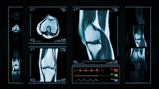 Knee MRI Scan. Blue. 4 videos in 1 file. Animation showing top, front, lateral view and ECG display. Each video is loopable. Medical Background. More options in my portfolio.