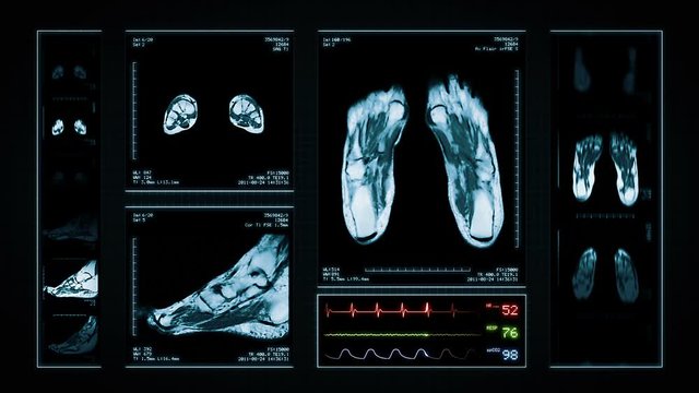 Foot MRI Scan. Blue. 3 videos in 1 file. Animation showing top, front, lateral view and ECG display. Each video is loopable. Medical Background. More options in my portfolio.