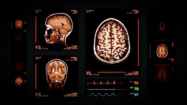 Brain MRI Scan. Amber. 4 videos in 1 file. Animation showing top, front, lateral view and ECG display. Each video is loopable. Medical Background. More options in my portfolio.