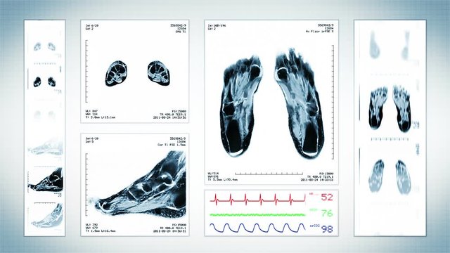 Foot MRI Scan. White. 3 videos in 1 file. Animation showing top, front, lateral view and ECG display. Each video is loopable. Medical Background. More options in my portfolio.