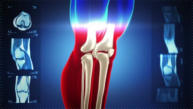 Highly detailed knee scan. Loopable. Red/white. Blue background. MRI images and also included. More color options in my portfolio.