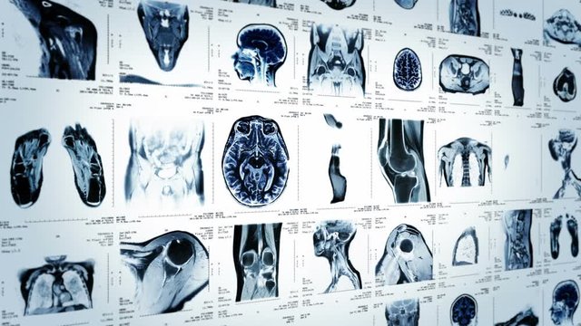 MRI video wall. White and Black. Loopable. Lateral view. 2 videos in 1 file. Composite video showing multiple MRI images including: head, neck, arm, foot, pelvis, etc. More options in my portfolio.     