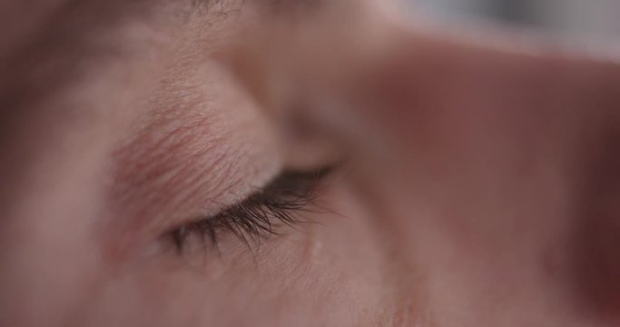 Man dropping medical eye drops into the eye macro closeup