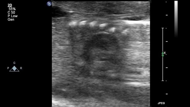 Ultrasound examination of the fetal heart.