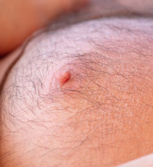 Fototapeta premium Hair on the chest and abdomen in a man