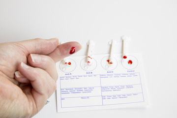 Home blood type testing