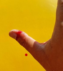 The man's hand had a wound from a knife with a blushing blood on a yellow background.