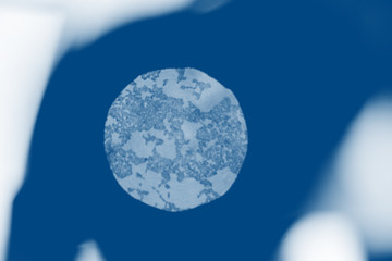 a molecule of gonorrhea through a microscope