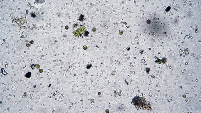 Diverse single-celled world of microorganisms and bacteria. Theme of laboratory biological research under microscope. Microscopic protozoa in a drop of water magnification. Microcosmic background