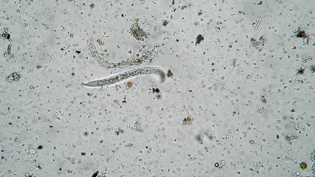 The nematode worm moves among numerous clusters of bacteria and microorganisms. Theme of laboratory biological research under microscope. Microscopic protozoa in a drop of water magnification.