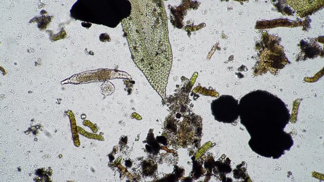A large rotifer moves among a variety of microorganisms. Theme of laboratory biological research under microscope. Microscopic protozoa in a drop of water magnification. Life of microorganisms.