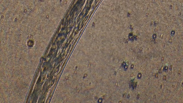 Microscopy of parasite worm nematode (Strongyloides stercoralis). Closeup movement of active parasite form in magnification 300x.
