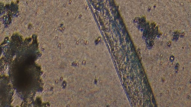 Microscopy of parasite worm nematode (Strongyloides stercoralis). Closeup movement of active parasite form in magnification 300x.