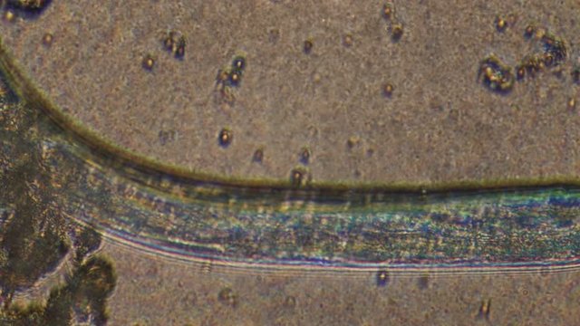 Microscopy of parasite worm nematode (Strongyloides stercoralis). Closeup movement of active parasite form in magnification 300x.