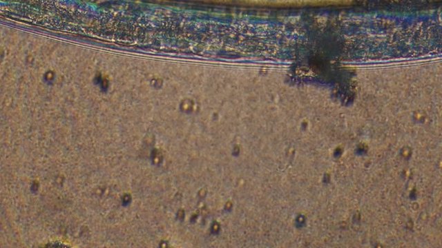 Microscopy of parasite worm nematode (Strongyloides stercoralis). Closeup movement of active parasite form in magnification 300x.