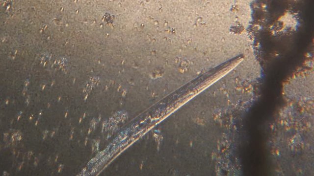 Microscopy of parasite worm nematode (Strongyloides stercoralis). Movement of active parasite infection form in magnification 150x.
