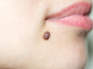 beautiful, female, red lips and mole close-up